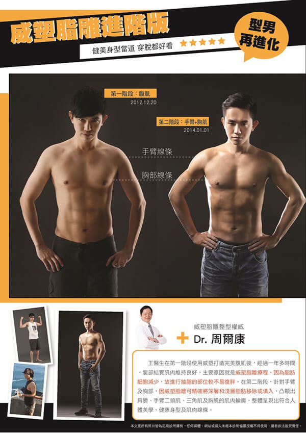 威塑脂肪雕刻 | 尼斯診所 | - 威塑脂肪雕刻,完美身型最佳捷徑!