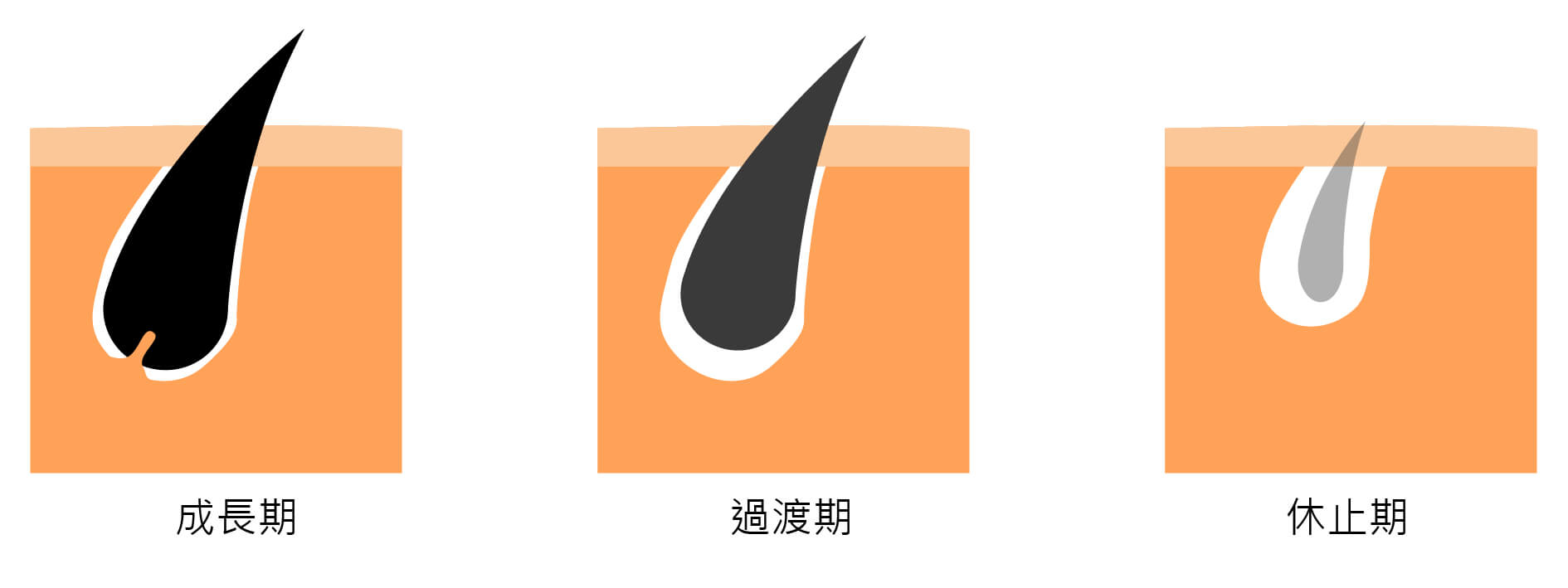 毛囊-02
